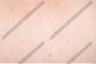 photo texture of white skin 0043